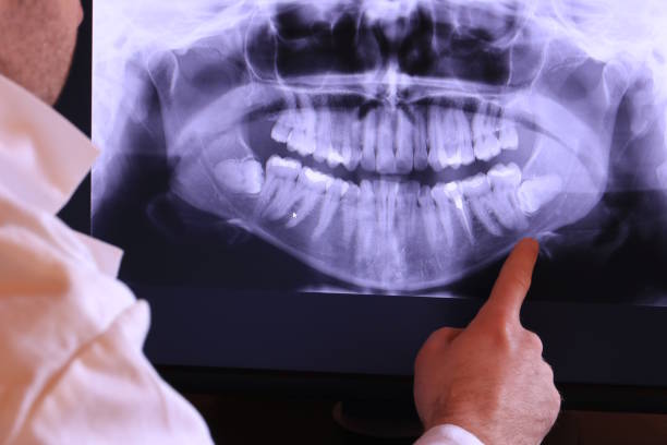 Best Emergency Broken Tooth Repair in Sparks, TX