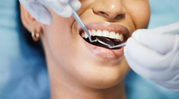 Best Emergency Wisdom Teeth Removal in Sparks, TX